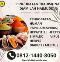 Pengobatan Tradisiona