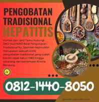 pengobatan hepatitis