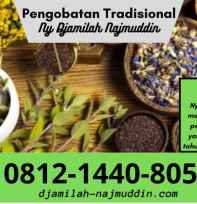 Pengobatan Papilloma