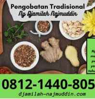 Pengobatan Hepatitis