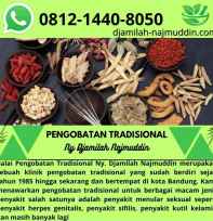 Pengobatan Herbal Di