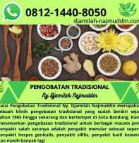 Cara Alami Mengobati