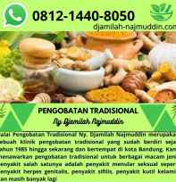 Pengobatan Tradisiona