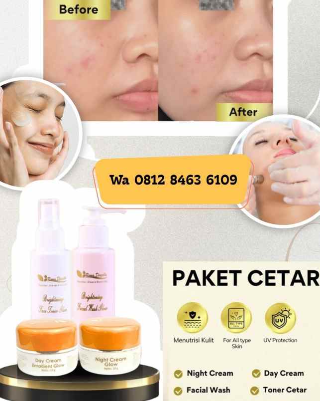 produk perawatan anjatan