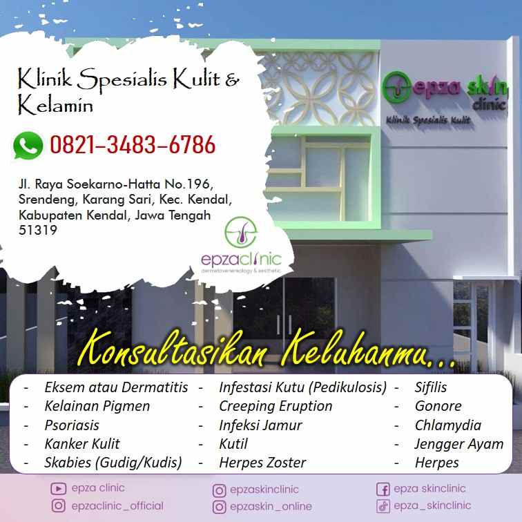 produk perawatan kota kendal