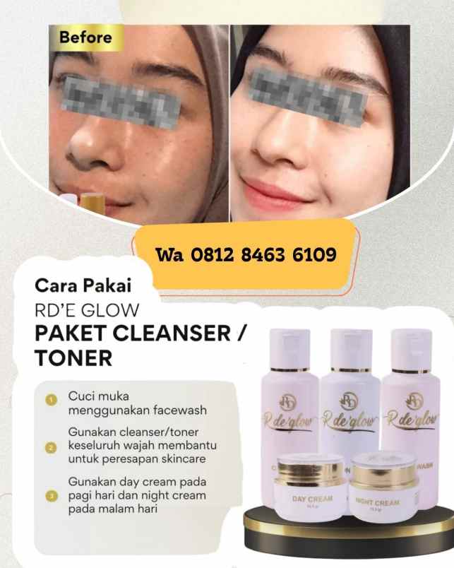 produk perawatan karanganyar